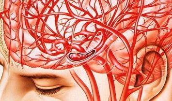 脳血管のイメージ